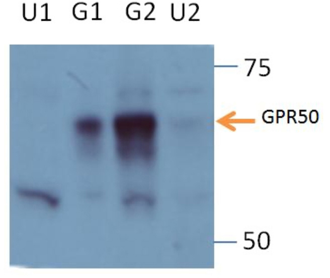 WB result of GPR50 antibody (Catalog No:111129, 1:5,000) by Dr. Qian Li, University of Edinburgh. U1: Lysates from SH-SY5Y cells, untransfected, no endogenous GPR50, negative control,15ug; G1: Lysates from HEK293 cells, with transfected GPR50, positive control, 2ug; G2: Lysates from HEK293 cells, with transfected GPR50, 10ug; U2: Lysates from HEK293 cells, untransfected, with endogenous GPR50, 10ug; U3: Lysates from HEK293 cells, untransfected, with endogenous GPR50, 10ug. Optimal dilution: 1 in 5000, Signal detection: ECL, Pierce; Exposure time: 10min.