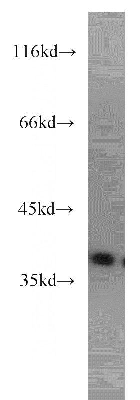 HepG2 cells were subjected to SDS PAGE followed by western blot with Catalog No:107856(AIP antibody) at dilution of 1:1000