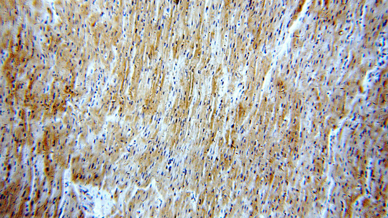 Immunohistochemical of paraffin-embedded human heart using Catalog No:112183(LDHA-Specific antibody) at dilution of 1:100 (under 10x lens)