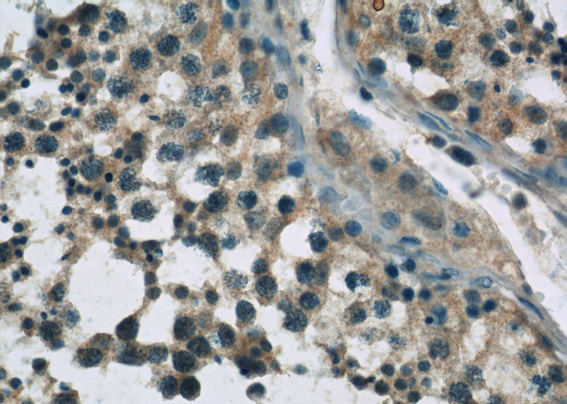 Immunohistochemistry of paraffin-embedded human testis slide using Catalog No:116627(UPF3B Antibody) at dilution of 1:50