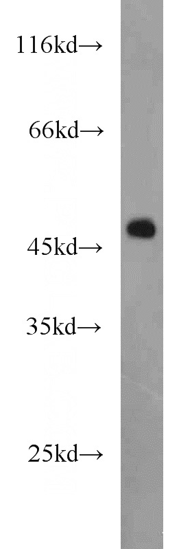 SKOV-3 cells were subjected to SDS PAGE followed by western blot with Catalog No:113705(PELO antibody) at dilution of 1:1000