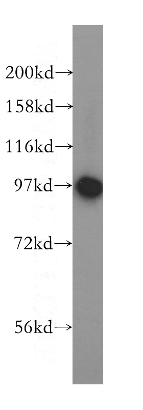 human brain tissue were subjected to SDS PAGE followed by western blot with Catalog No:114357(PYGB antibody) at dilution of 1:500