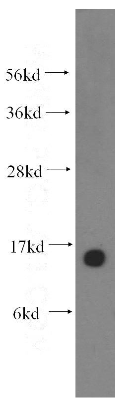 human brain tissue were subjected to SDS PAGE followed by western blot with Catalog No:113170(NGB antibody) at dilution of 1:500