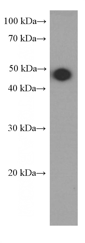 A431 cells were subjected to SDS PAGE followed by western blot with Catalog No:107596(SMYD3 Antibody) at dilution of 1:1000