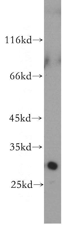 Jurkat cells were subjected to SDS PAGE followed by western blot with Catalog No:112298(LOX antibody) at dilution of 1:600