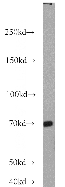 mouse brain tissue were subjected to SDS PAGE followed by western blot with Catalog No:112670(BBS13 antibody) at dilution of 1:1000
