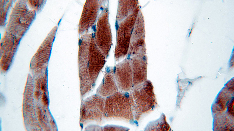 Immunohistochemical of paraffin-embedded human skeletal muscle using Catalog No:113089(NEB-Specific antibody) at dilution of 1:50 (under 40x lens)