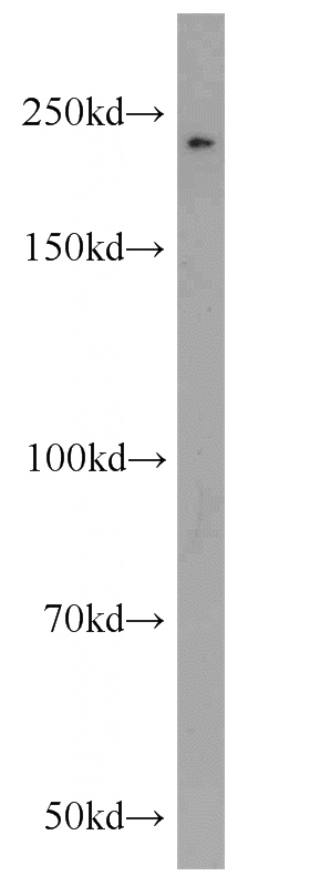 Jurkat cells were subjected to SDS PAGE followed by western blot with Catalog No:109408(CLTCL1 antibody) at dilution of 1:800