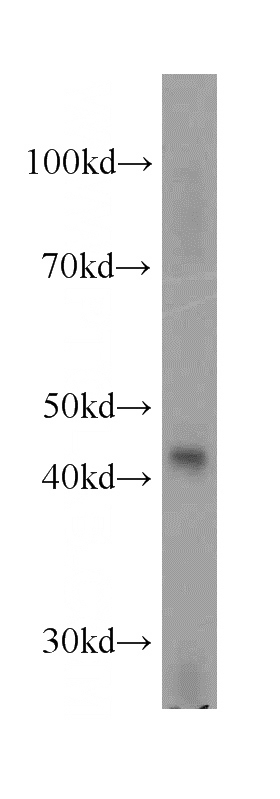 human testis tissue were subjected to SDS PAGE followed by western blot with Catalog No:115638(STAC3 antibody) at dilution of 1:300