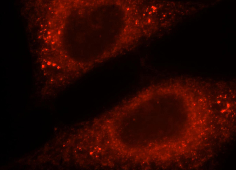 Immunofluorescent analysis of HepG2 cells, using PC antibody Catalog No:114365 at 1:25 dilution and Rhodamine-labeled goat anti-rabbit IgG (red).