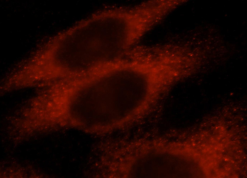 Immunofluorescent analysis of Hela cells, using KLHL18 antibody Catalog No:112095 at 1:25 dilution and Rhodamine-labeled goat anti-rabbit IgG (red).