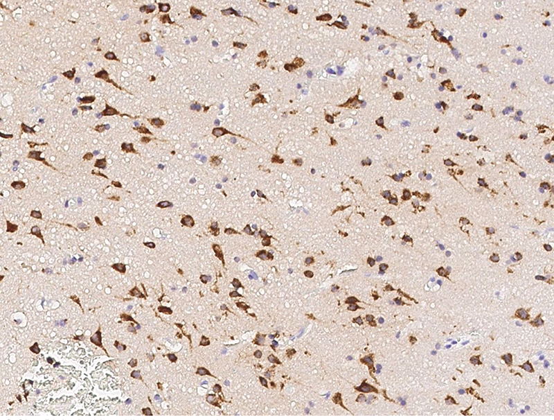Human Neuroserpin/SerpinI1 Immunohistochemistry(IHC) 14844