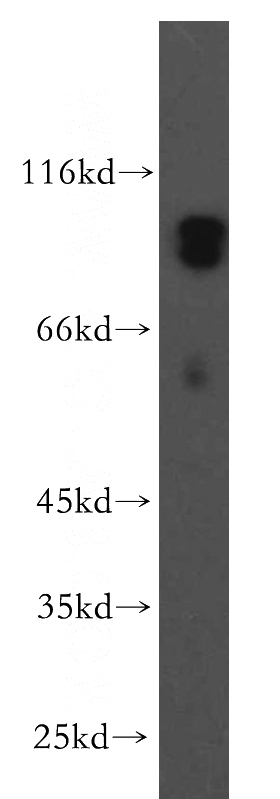 human brain tissue were subjected to SDS PAGE followed by western blot with Catalog No:112480(CTAK1 antibody) at dilution of 1:200