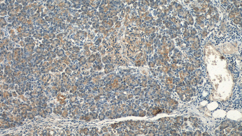 Immunohistochemical of paraffin-embedded human pancreas using Catalog No:116722(VAV2 antibody) at dilution of 1:50 (under 10x lens)
