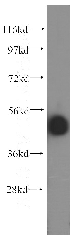 HepG2 cells were subjected to SDS PAGE followed by western blot with Catalog No:111871(INTS12 antibody) at dilution of 1:1000
