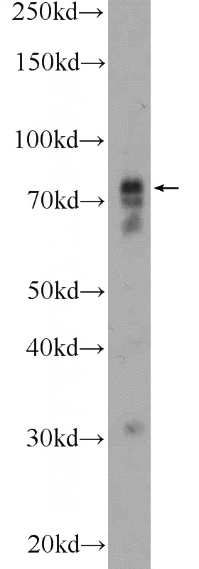 COLO 320 cells were subjected to SDS PAGE followed by western blot with Catalog No:116025(TGFBRAP1 Antibody) at dilution of 1:300