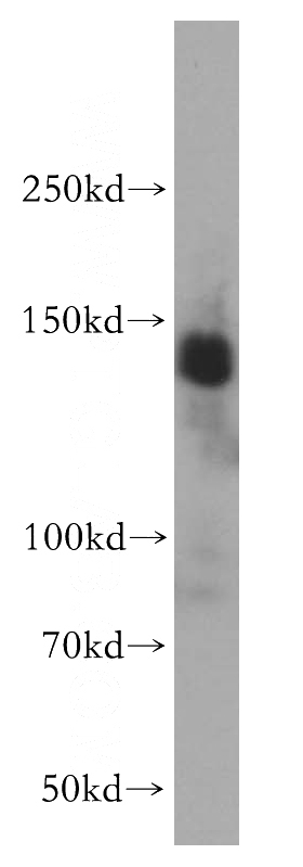 HEK-293 cells were subjected to SDS PAGE followed by western blot with Catalog No:116012(GTF2I antibody) at dilution of 1:800