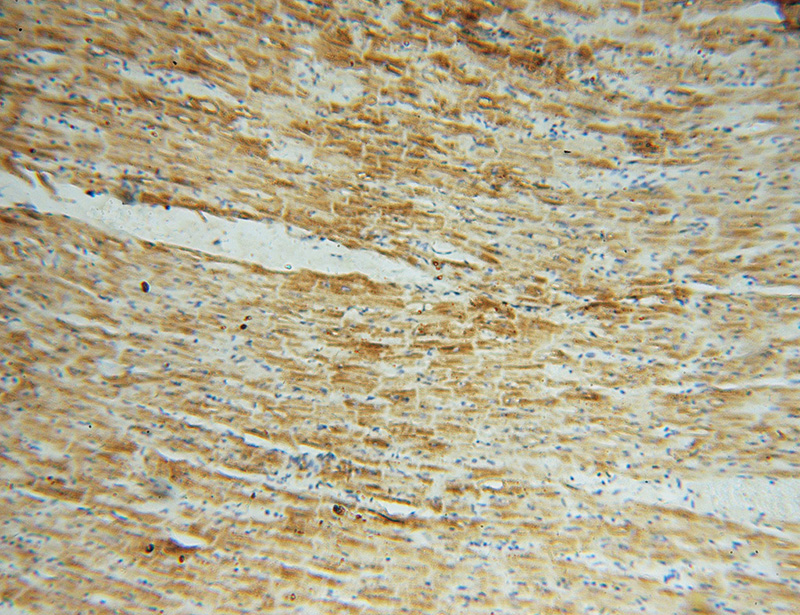 Immunohistochemical of paraffin-embedded human heart using Catalog No:113083(NDUFS5 antibody) at dilution of 1:50 (under 10x lens)