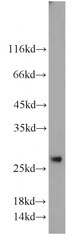HEK-293 cells were subjected to SDS PAGE followed by western blot with Catalog No:108788(C7orf30 antibody) at dilution of 1:1000