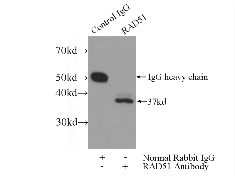 IP Result of anti-RAD51 (IP:Catalog No:114515, 3ug; Detection:Catalog No:114515 1:1000) with mouse testis tissue lysate 4000ug.