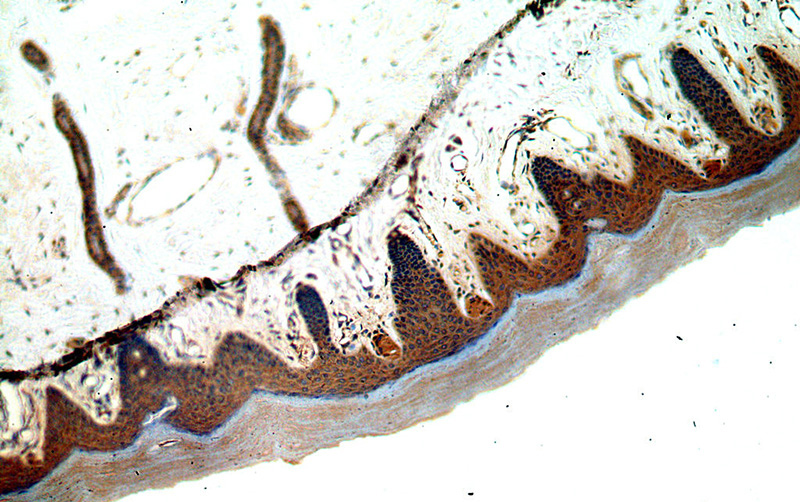 Immunohistochemical of paraffin-embedded human skin using Catalog No:111166(GSDMD antibody) at dilution of 1:50 (under 10x lens)