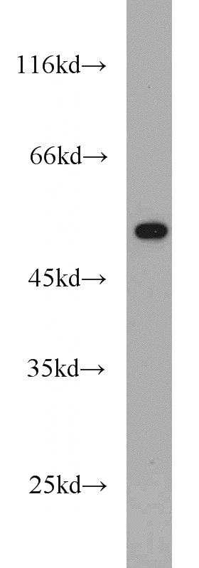 A549 cells were subjected to SDS PAGE followed by western blot with Catalog No:116303(TRIM21 antibody) at dilution of 1:500