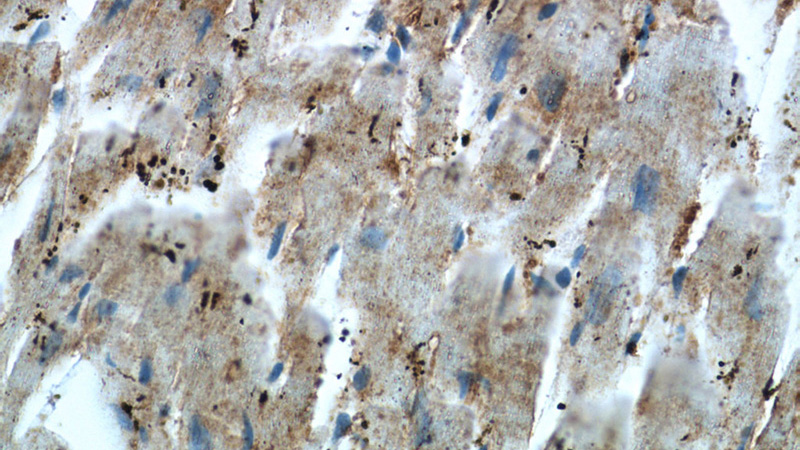Immunohistochemistry of paraffin-embedded human heart tissue slide using Catalog No:107317(MB Antibody) at dilution of 1:50 (under 40x lens)