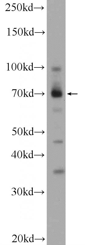 HL-60 cells were subjected to SDS PAGE followed by western blot with Catalog No:116917(ZBTB44 Antibody) at dilution of 1:600