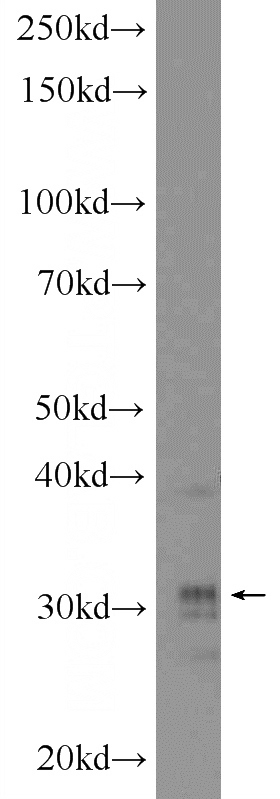 A375 cells were subjected to SDS PAGE followed by western blot with Catalog No:111442(HOXD8 Antibody) at dilution of 1:300