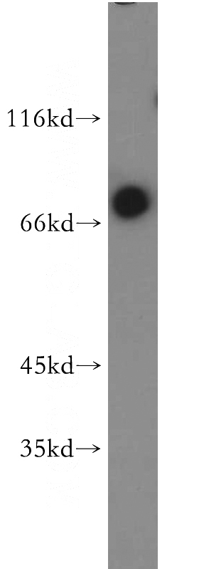 Jurkat cells were subjected to SDS PAGE followed by western blot with Catalog No:110152(TCF3 antibody) at dilution of 1:500
