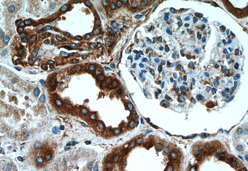 Immunohistochemistry of paraffin-embedded human kidney tissue slide using Catalog No:114906(RPLP1 Antibody) at dilution of 1:50 (under 40x lens)