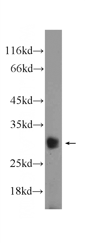 PC-3 cells were subjected to SDS PAGE followed by western blot with Catalog No:117097(BCL2L12 Antibody) at dilution of 1:1000