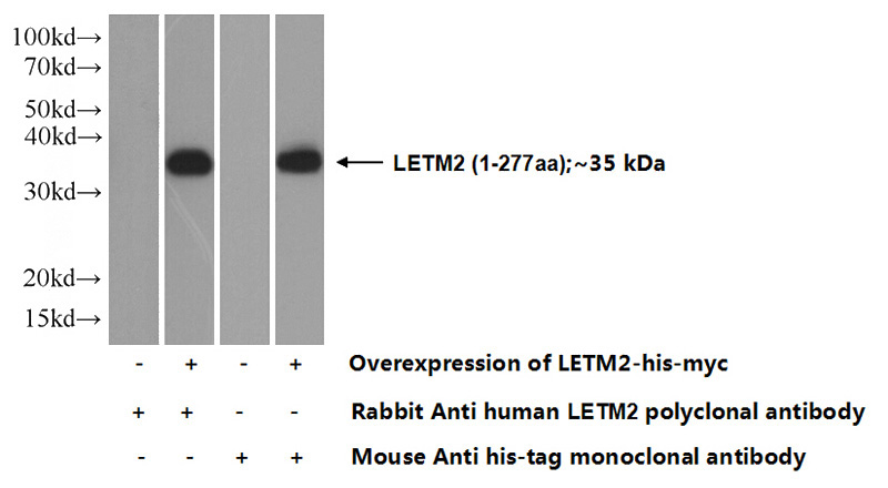 Transfected HEK-293 cells were subjected to SDS PAGE followed by western blot with Catalog No:112202(LETM2 Antibody) at dilution of 1:1000