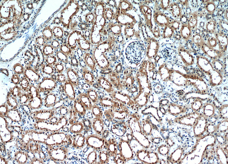 Immunohistochemical of paraffin-embedded human kidney using Catalog No:108678(C1orf50 antibody) at dilution of 1:50 (under 10x lens)