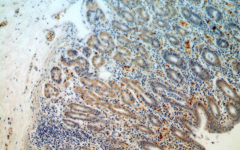 Immunohistochemical of paraffin-embedded human stomach using Catalog No:116687(USP49 antibody) at dilution of 1:50 (under 10x lens)