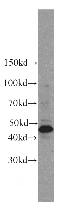 HeLa cells were subjected to SDS PAGE followed by western blot with Catalog No:109797(KRT17 antibody) at dilution of 1:2000