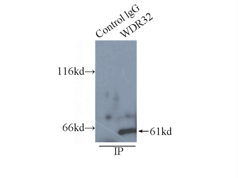 IP Result of anti-WDR32 (IP:Catalog No:116862, 4ug; Detection:Catalog No:116862 1:300) with HepG2 cells lysate 6000ug.