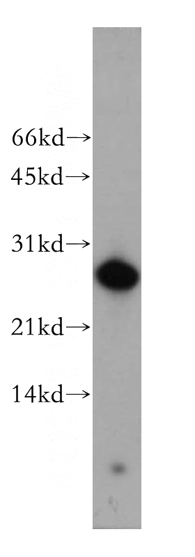 human placenta tissue were subjected to SDS PAGE followed by western blot with Catalog No:107924(AK3 antibody) at dilution of 1:500