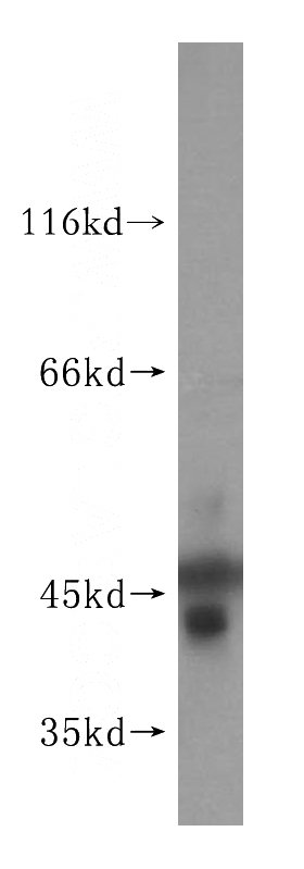 PC-3 cells were subjected to SDS PAGE followed by western blot with Catalog No:117232(BRE antibody) at dilution of 1:500