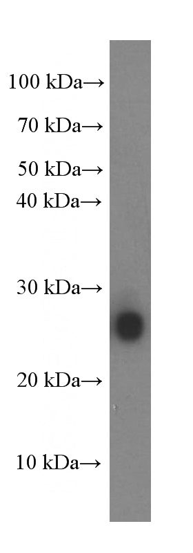 fetal human brain tissue were subjected to SDS PAGE followed by western blot with Catalog No:107359(KCNMB4 Antibody) at dilution of 1:1000