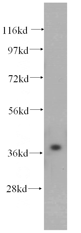 human liver tissue were subjected to SDS PAGE followed by western blot with Catalog No:113728(PEX16 antibody) at dilution of 1:500