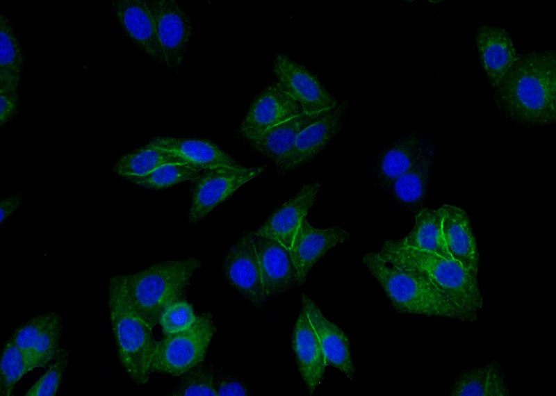 Immunofluorescent analysis of HepG2 cells using Catalog No:111415(HLA class I (HLA-B) Antibody) at dilution of 1:50 and Alexa Fluor 488-congugated AffiniPure Goat Anti-Rabbit IgG(H+L)