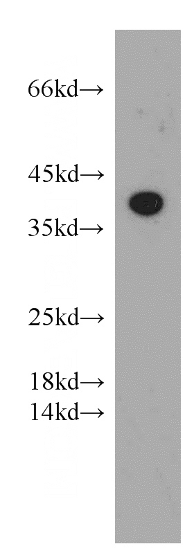 SH-SY5Y cells were subjected to SDS PAGE followed by western blot with Catalog No:107784(ADORA1 antibody) at dilution of 1:500