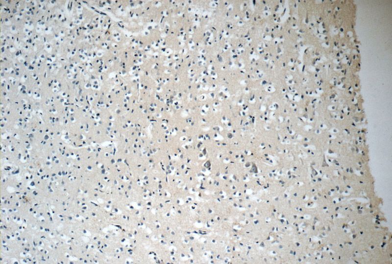 Immunohistochemistry of paraffin-embedded human brain tissue slide using Catalog No:108186(ARHGEF4 Antibody) at dilution of 1:50 (under 10x lens)