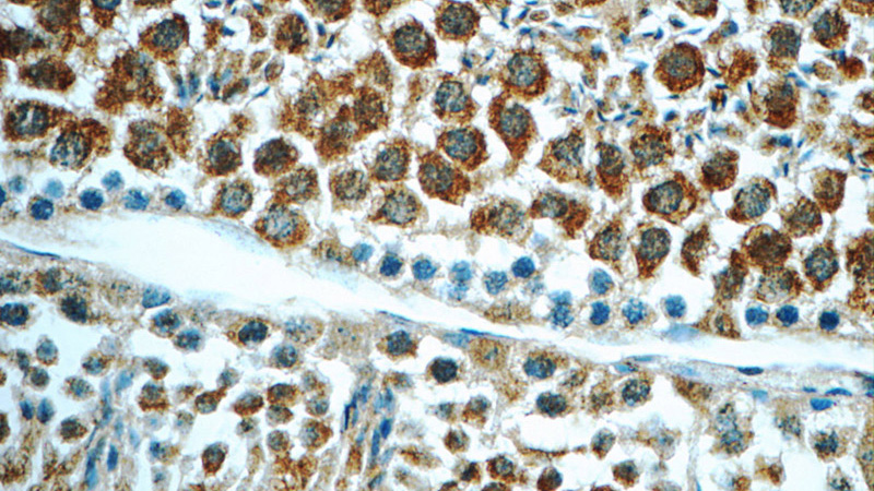 Immunohistochemistry of paraffin-embedded mouse testis tissue slide using Catalog No:108080(ANKRD54 Antibody) at dilution of 1:50 (under 40x lens)
