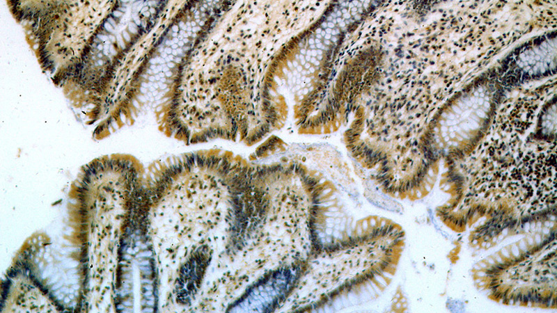 Immunohistochemical of paraffin-embedded human colon using Catalog No:114604(RBM19 antibody) at dilution of 1:50 (under 10x lens)