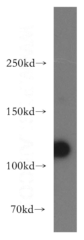 human kidney tissue were subjected to SDS PAGE followed by western blot with Catalog No:114055(PKD2 antibody) at dilution of 1:300