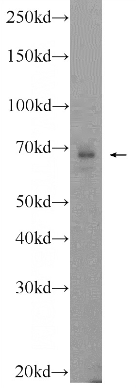 PC-3 cells were subjected to SDS PAGE followed by western blot with Catalog No:114987(KIAA0892 Antibody) at dilution of 1:600