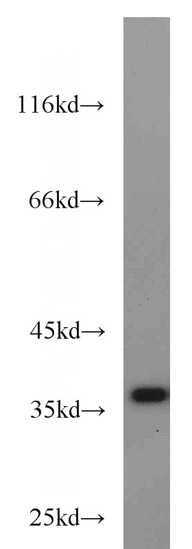 HeLa cells were subjected to SDS PAGE followed by western blot with Catalog No:111898(JTV1 antibody) at dilution of 1:1000