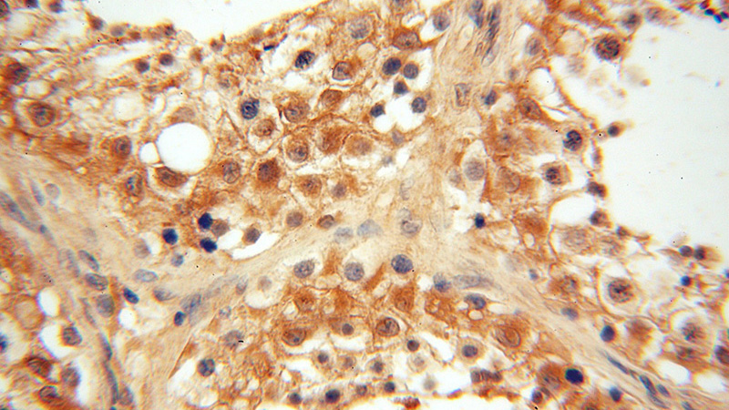 Immunohistochemical of paraffin-embedded human testis using Catalog No:116719(VASP antibody) at dilution of 1:100 (under 40x lens)